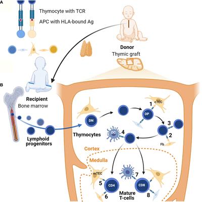 Current and Future Therapeutic Approaches for Thymic Stromal Cell Defects